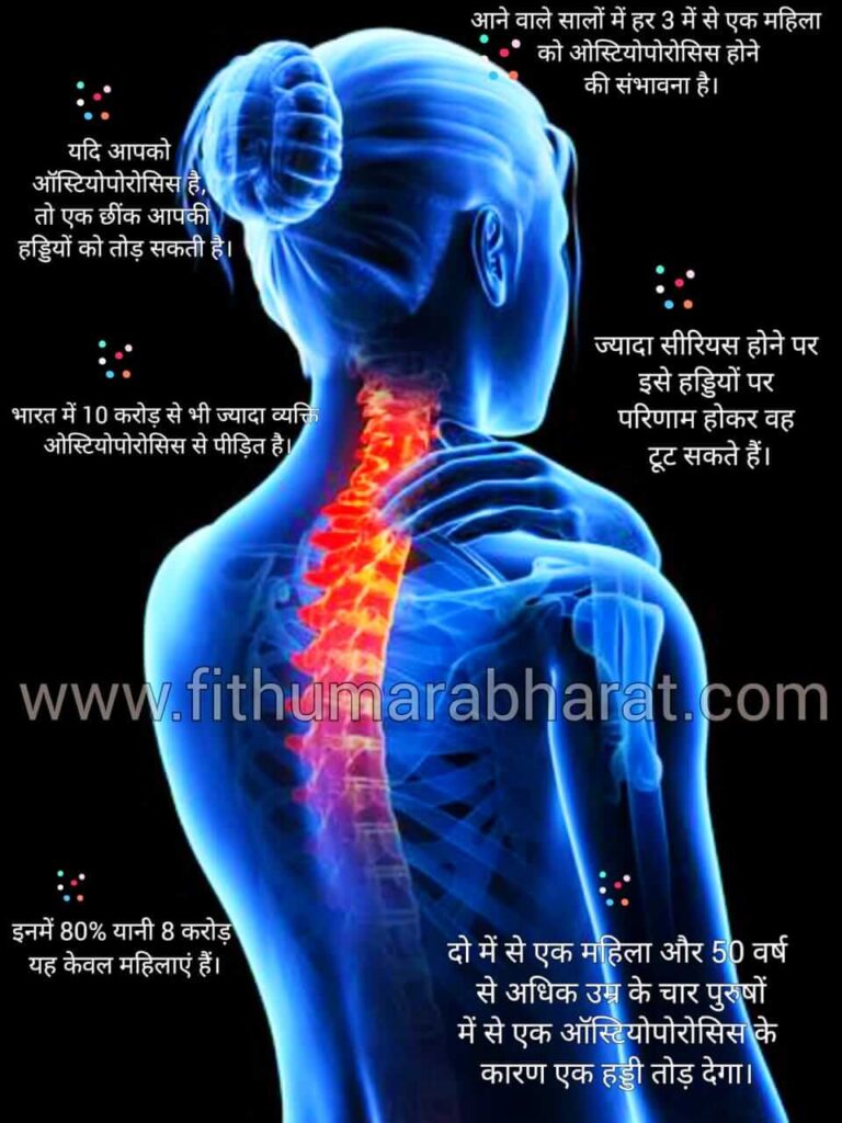 Studies on Osteoporosis