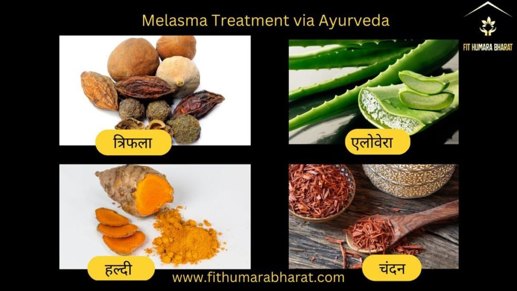 Melasma Treatment via Ayurveda