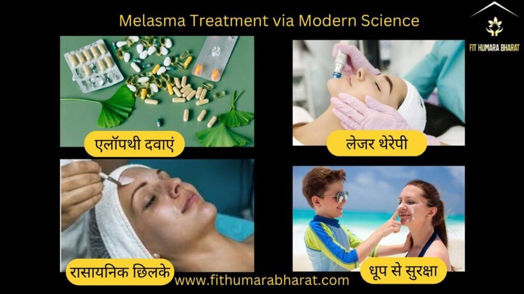 Melasma Treatment via Modern Science