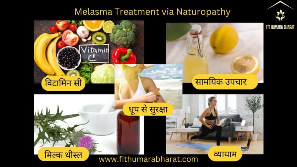 Melasma Treatment via Naturopathy
