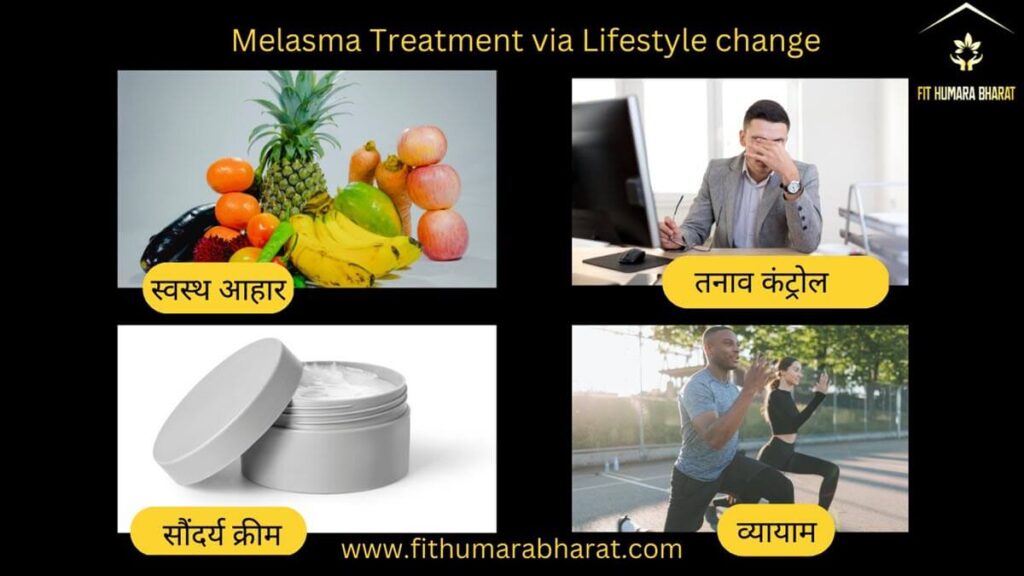 Melasma Treatment via Lifestyle Changes