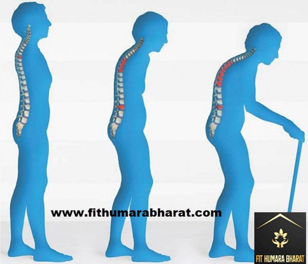 back pain because of Osteoporosis with Fit humara bharat