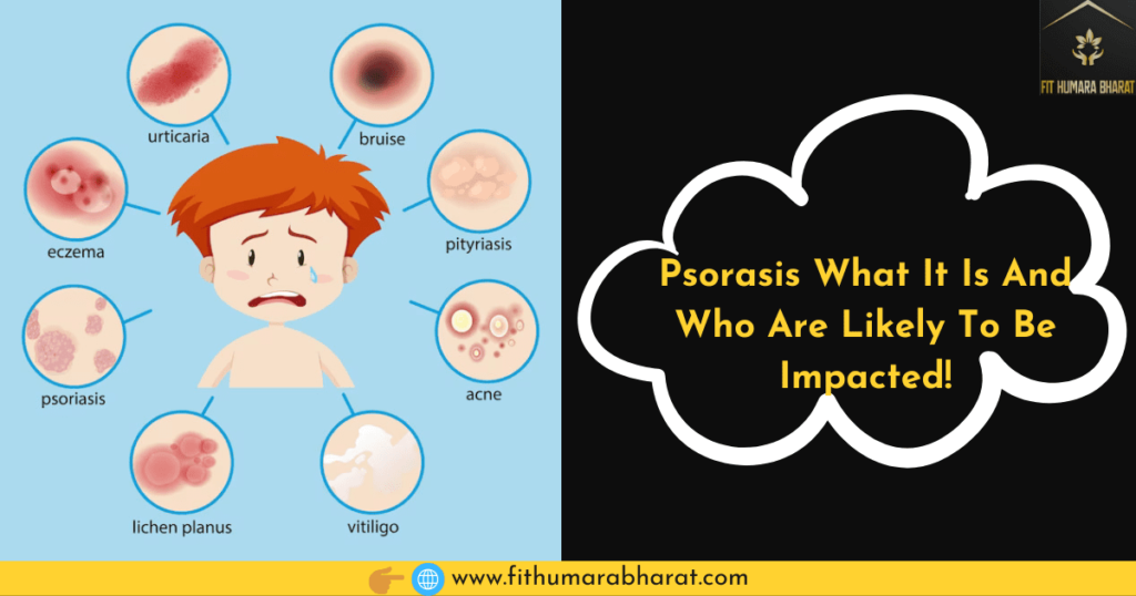 Psorasis What It Is And Who Are Likely To Be Impacted